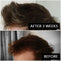 BASICS KIT FOR MEN<br>1-Month HairAnchoring Essences